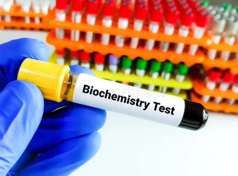 Biochemistry Tests