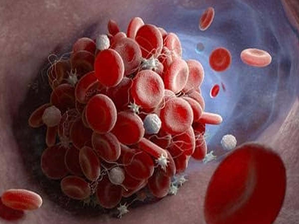 coagulation Tests